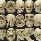 Osteo3D Releases Online Repository of Medical Models for 3D Printing