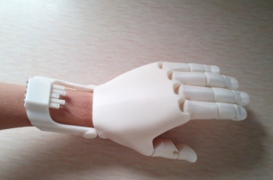 5-летний мальчик стал первым потерпевшим от ожогов в Китае, получившим 3D-печатную руку