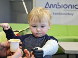 Ambionics запатентовала разработку гидравлических протезов для младенцев