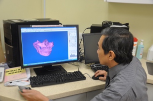 Челюстная кость была успешно восстановлена благодаря технологии 3D-печати