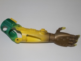 Компания Моторика создала 3D-печатный протез по дизайну пациентки