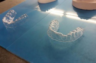 Студент напечатал зубные скобы на принтере