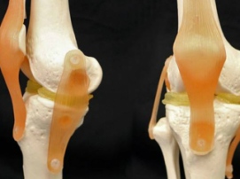 Учёные создали эффективный материал для 3D-имплантатов коленных хрящей