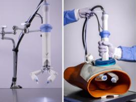 У Китаї робот успішно провів пацієнтці імплантацію 2-х зубів