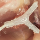 Восстановление повреждённых нервов при помощи 3D-печати