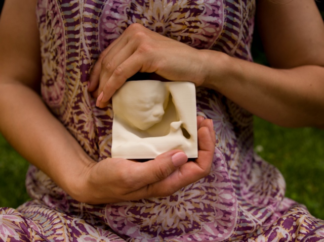 3D-печать позволяет слепым родителям «увидеть» своего будущего ребёнка