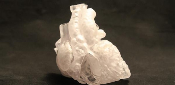 Жизнь новорожденного спасли медики при помощи 3D-модели сердца