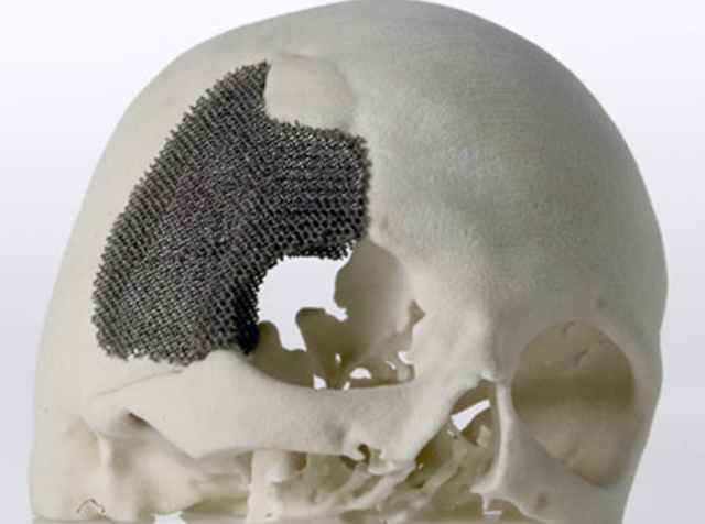 Объём рынка медицинской 3D-печати будет ежегодно увеличиваться на 17,5%