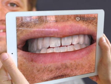 Swiss startup Kapanu created convenient dental AR application