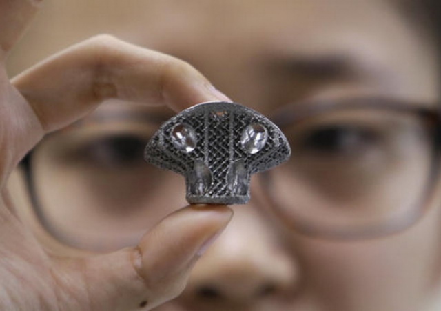 В Китае двум пациенткам успешно пересадили 3D-печатные костные имплантаты